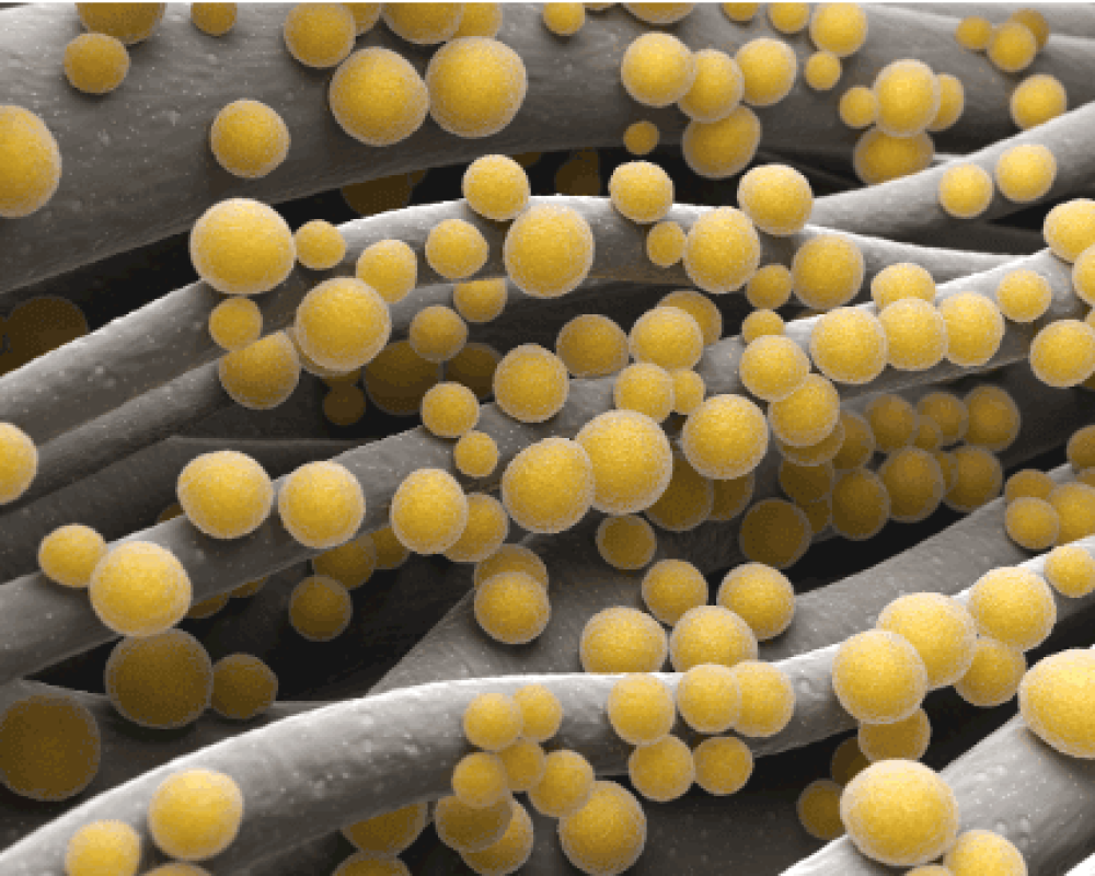 Mrsa Facts & Why You Need Professional Biohazard Clean Up